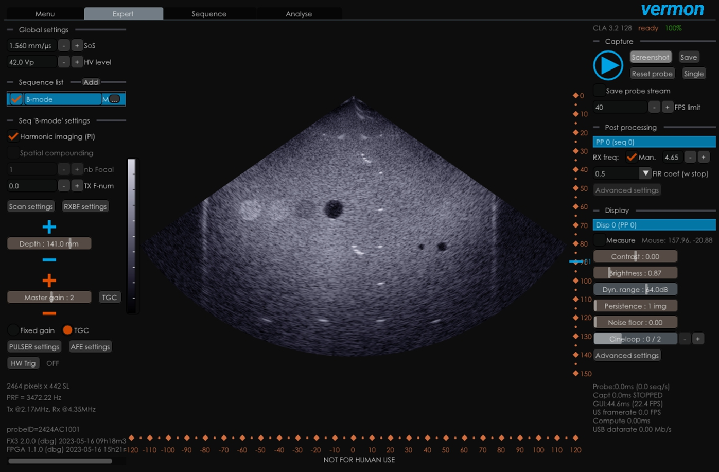 Expert tab for US imaging